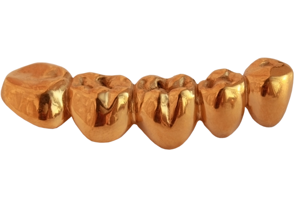 A set of gold teeth